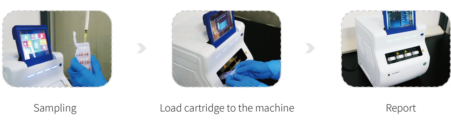 Toxoplasma Gondii Detection Kit